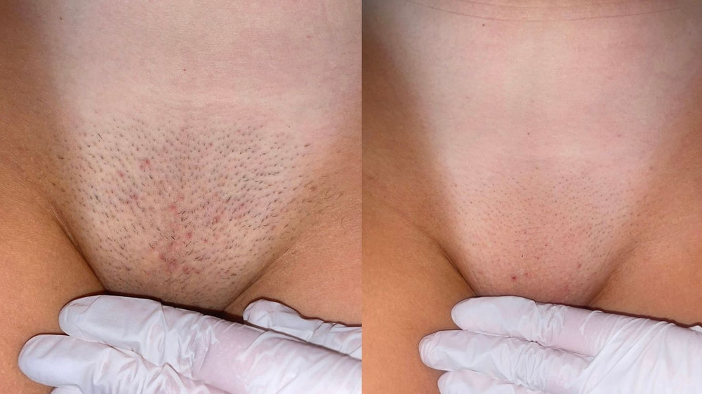 SHAN Laser & Skin